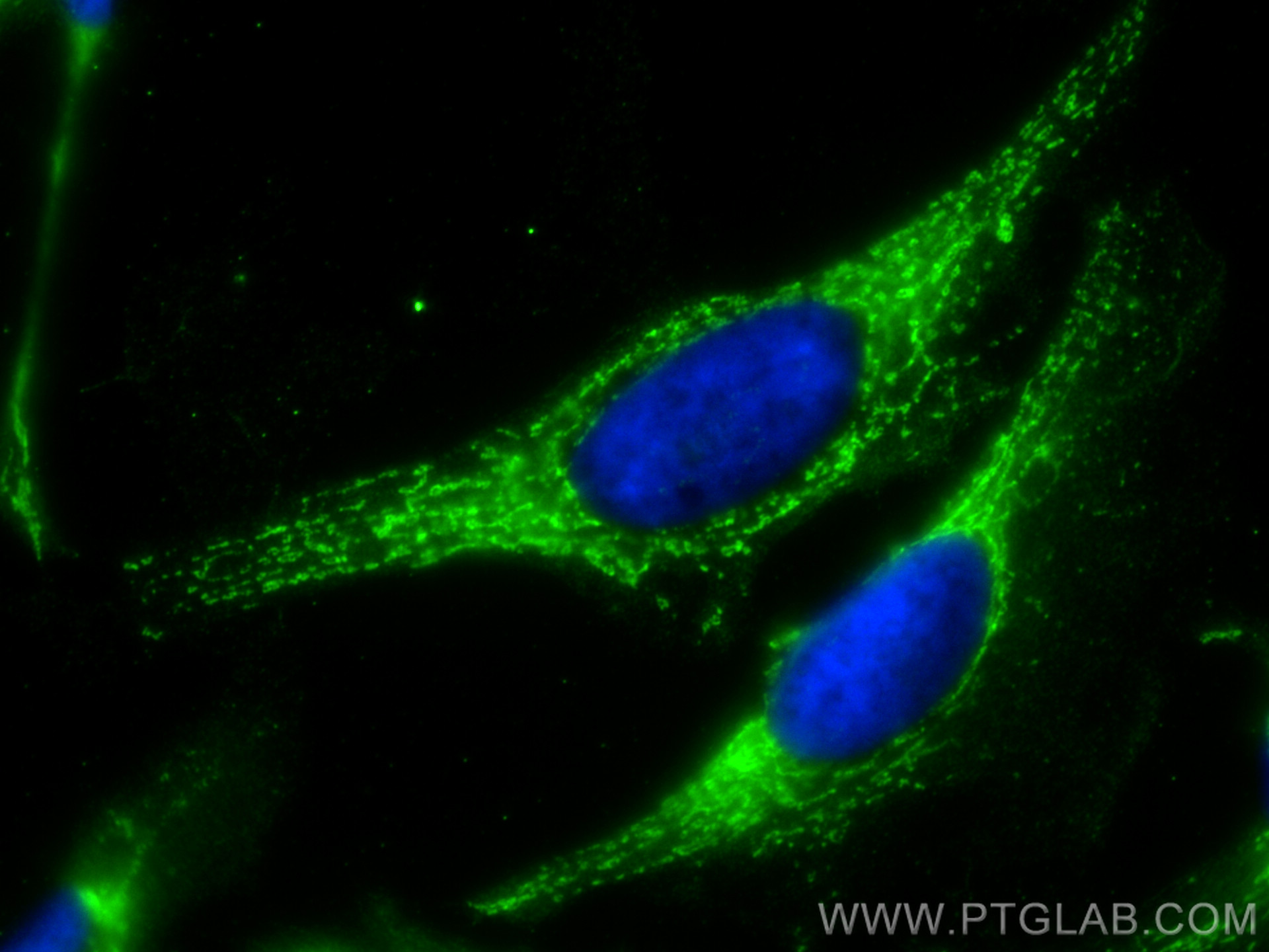 IF Staining of HeLa using 67408-1-Ig (same clone as 67408-1-PBS)