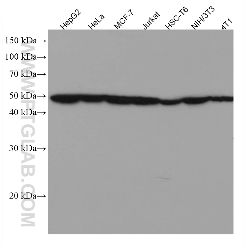 MAT1A