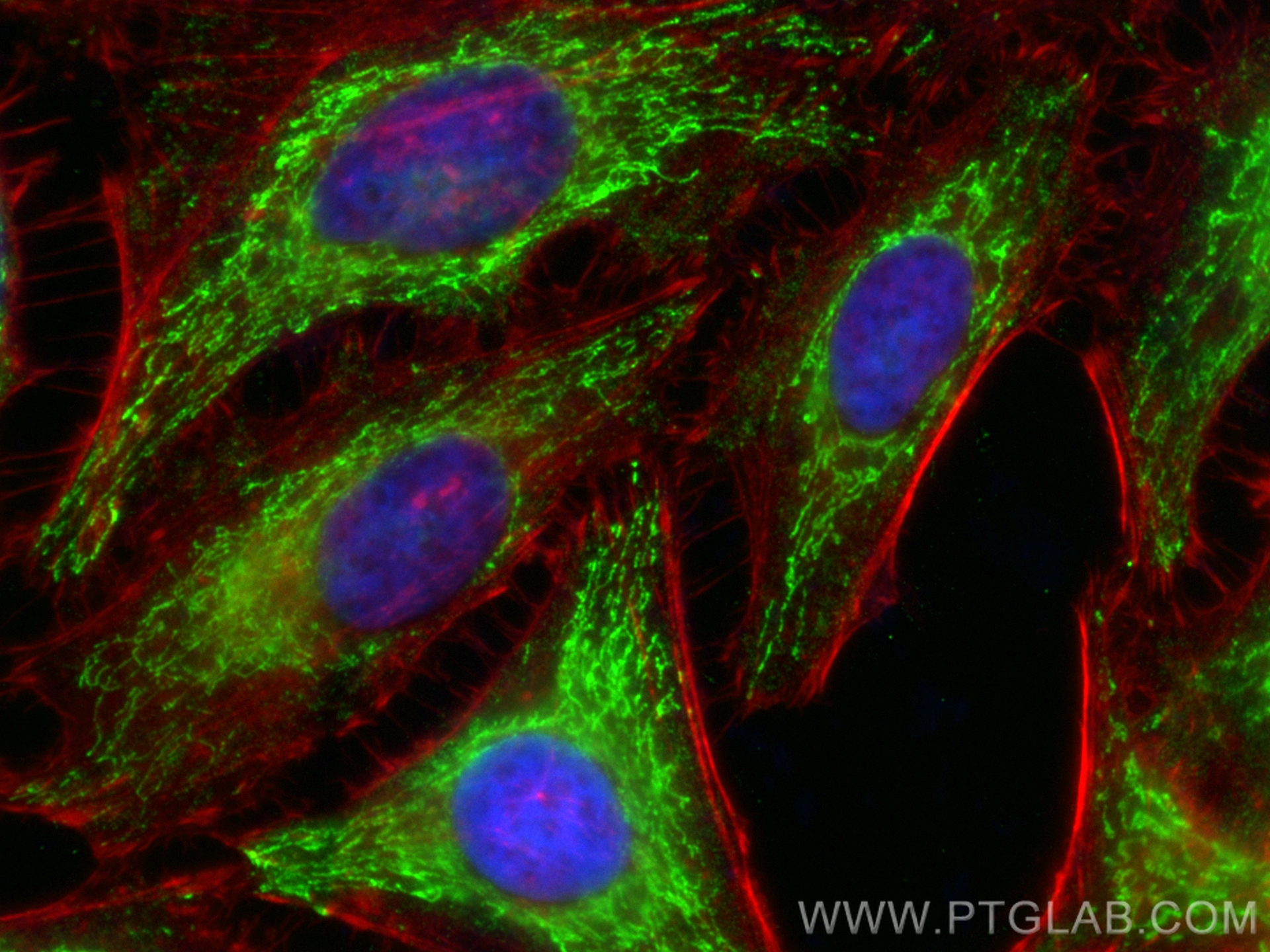 IF Staining of HeLa using CL488-67408