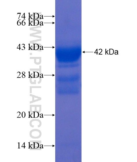 MATN3 fusion protein Ag21932 SDS-PAGE