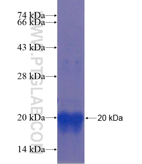 MATN3 fusion protein Ag21954 SDS-PAGE