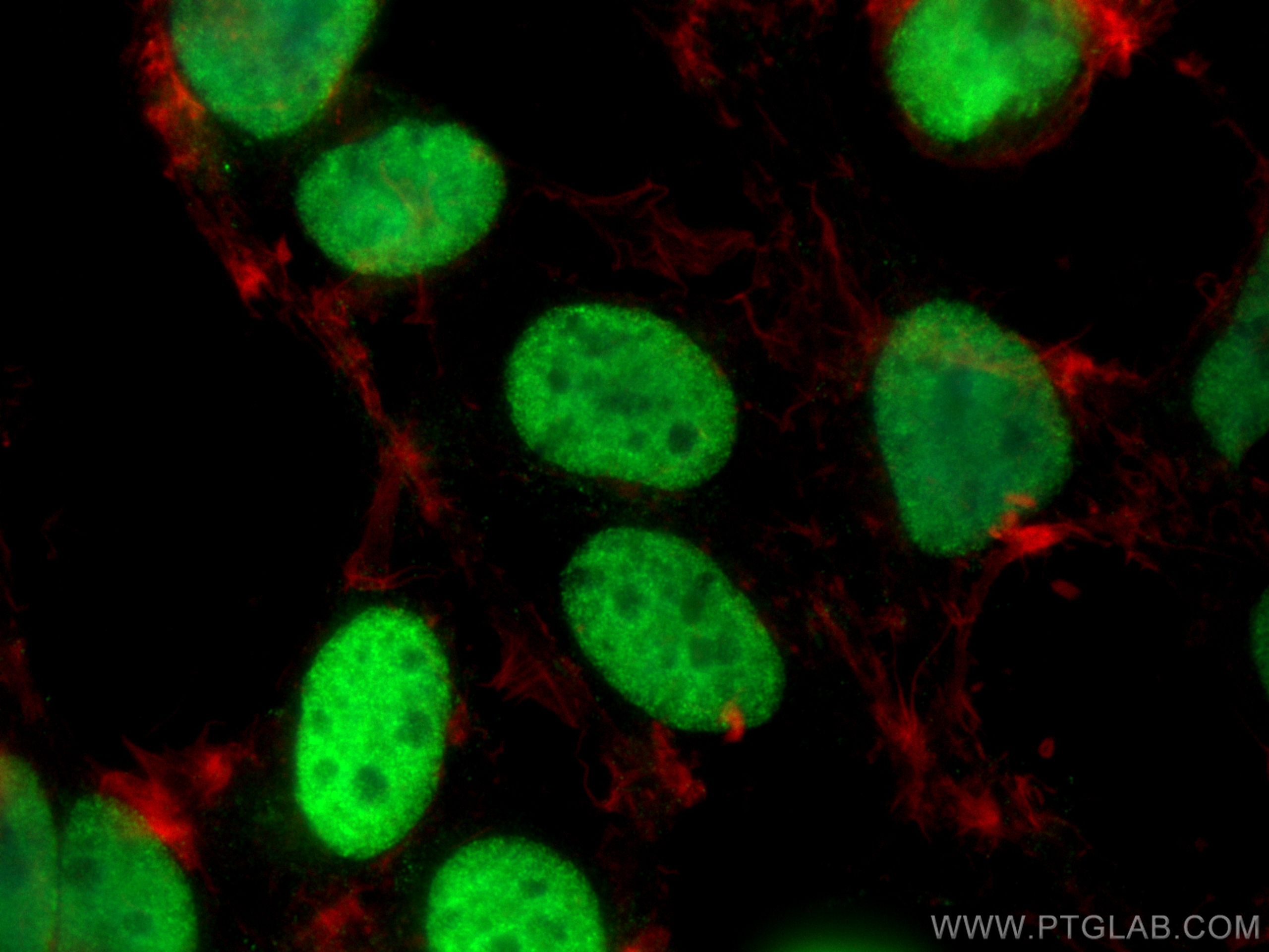 IF Staining of HEK-293 using 12202-2-AP