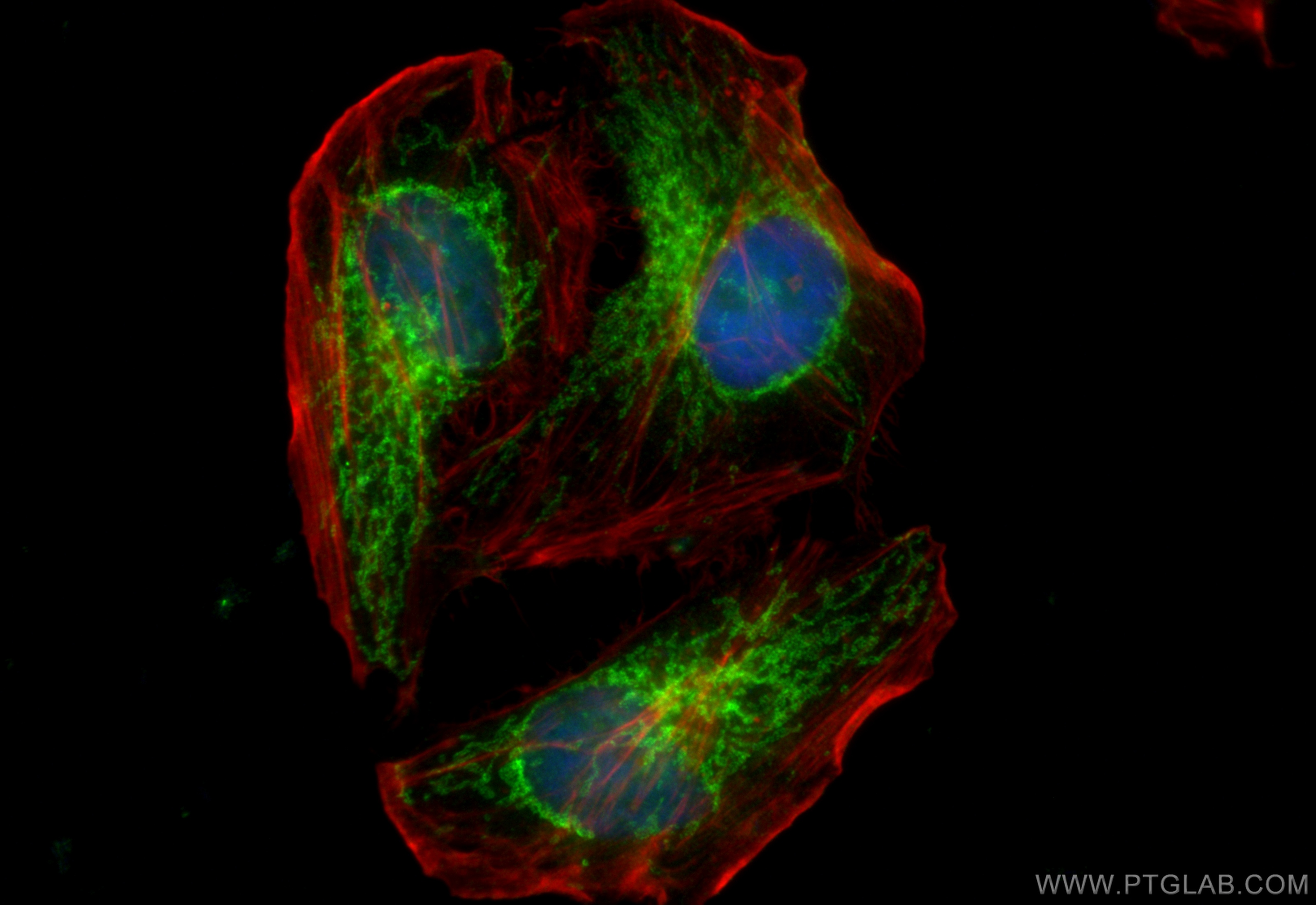 IF Staining of HeLa using CL488-14341