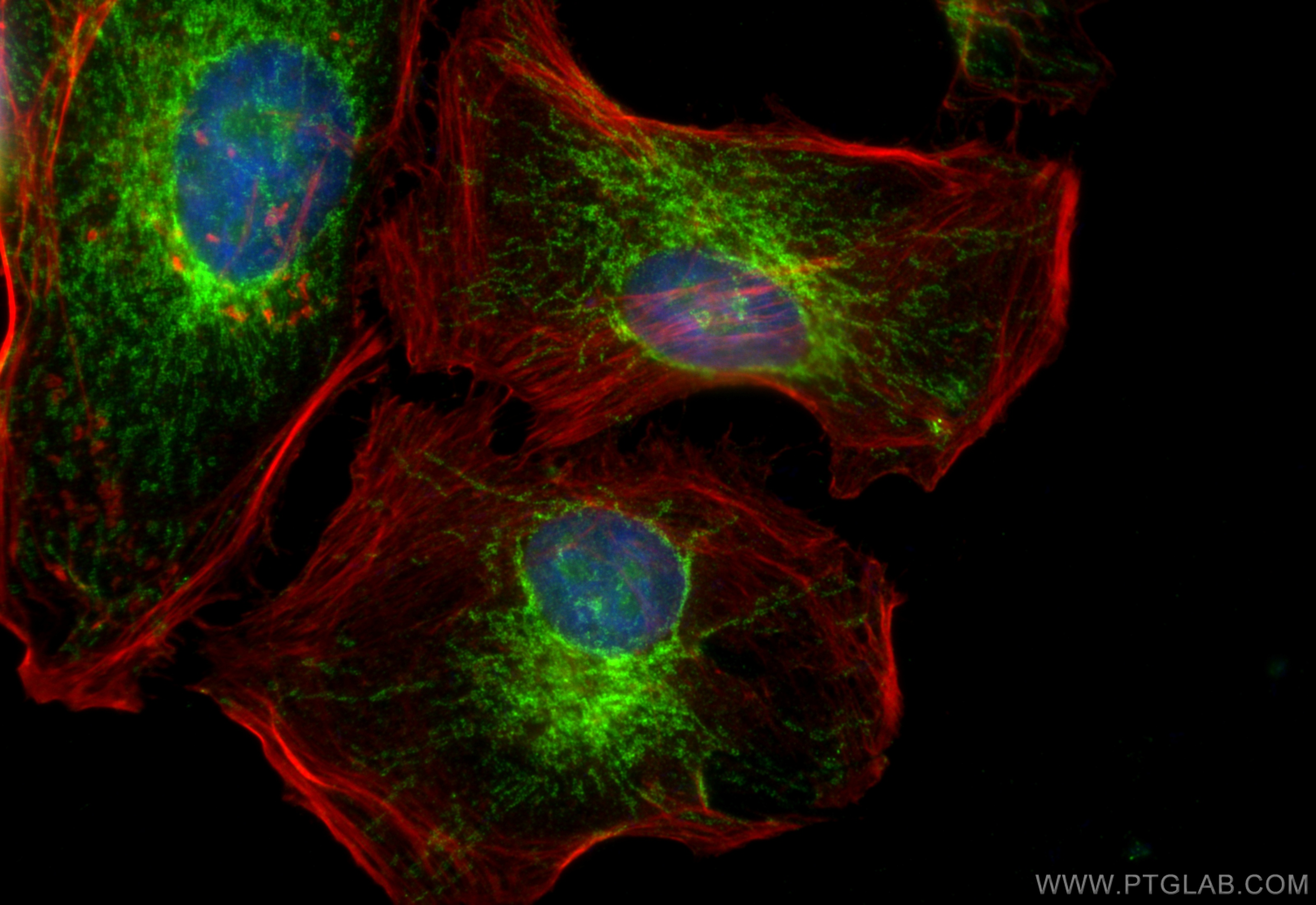 IF Staining of HeLa using 14341-1-AP