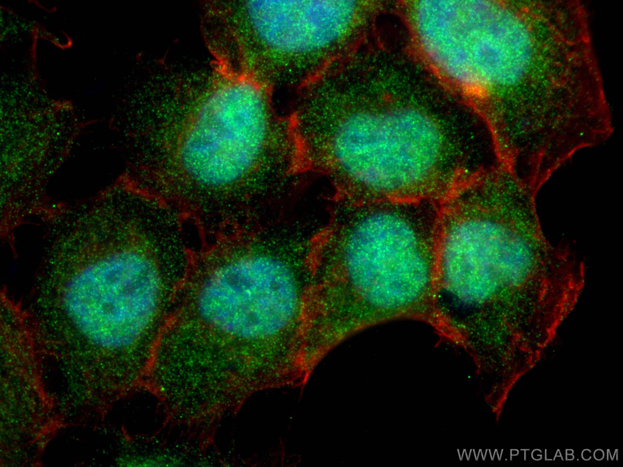 IF Staining of A431 using 21068-1-AP