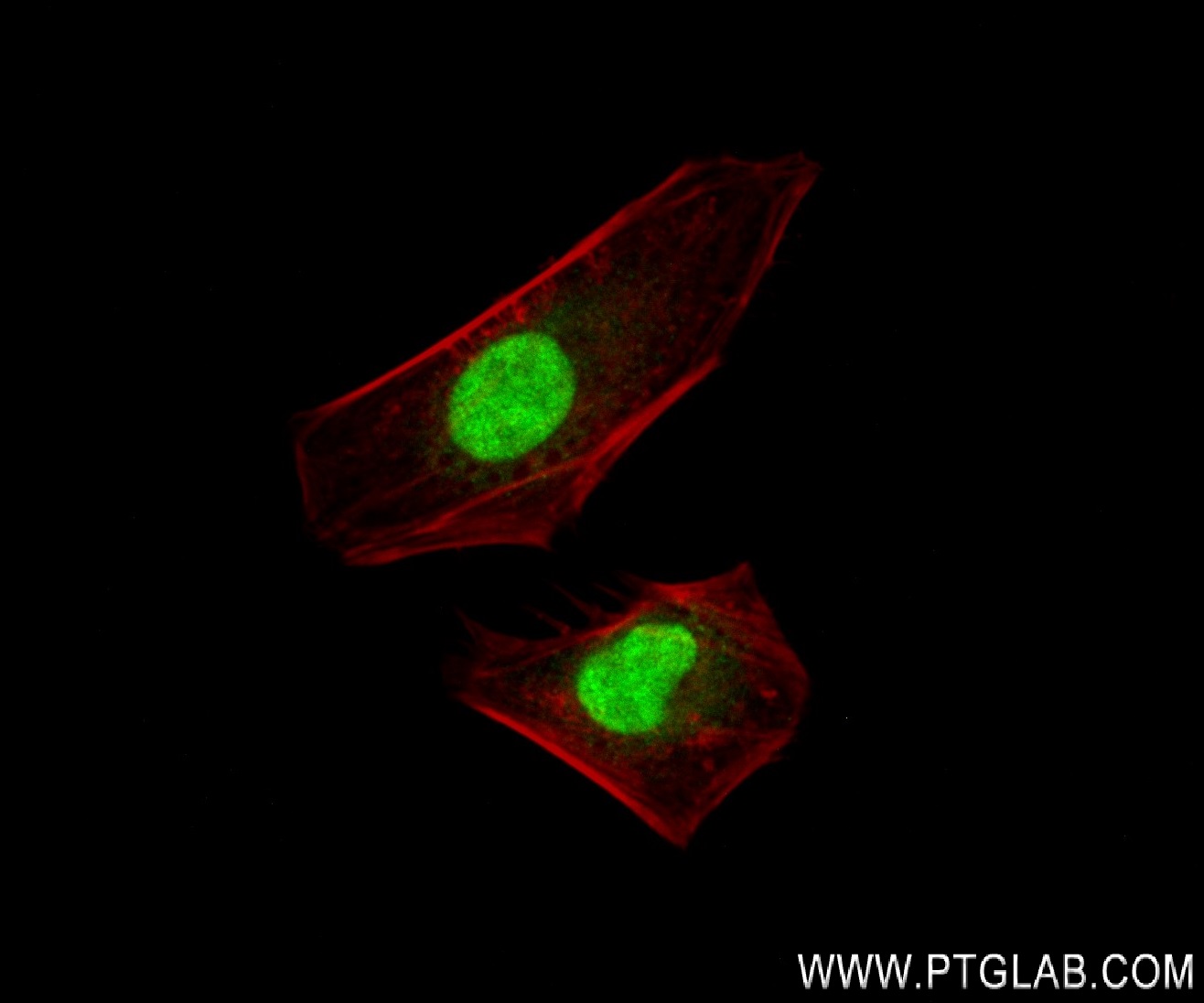 IF Staining of HeLa using 82852-3-RR