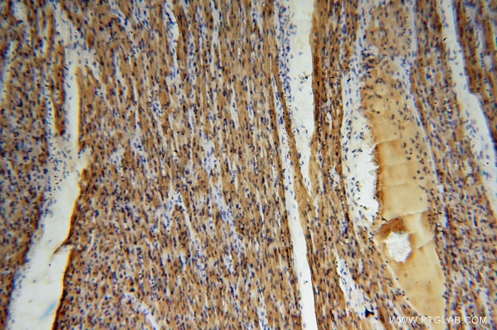 IHC staining of human heart using 16048-1-AP