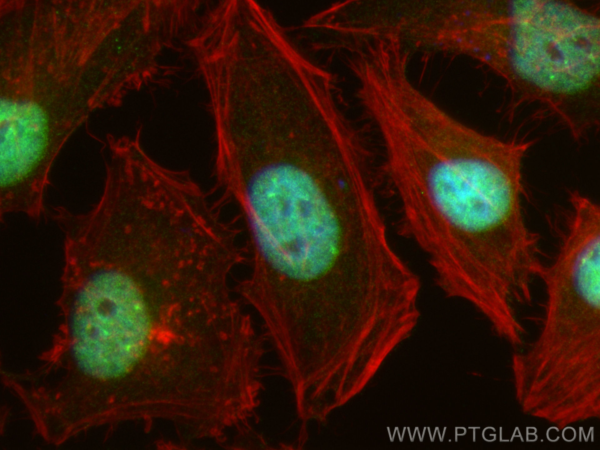 IF Staining of HeLa using 29998-1-AP