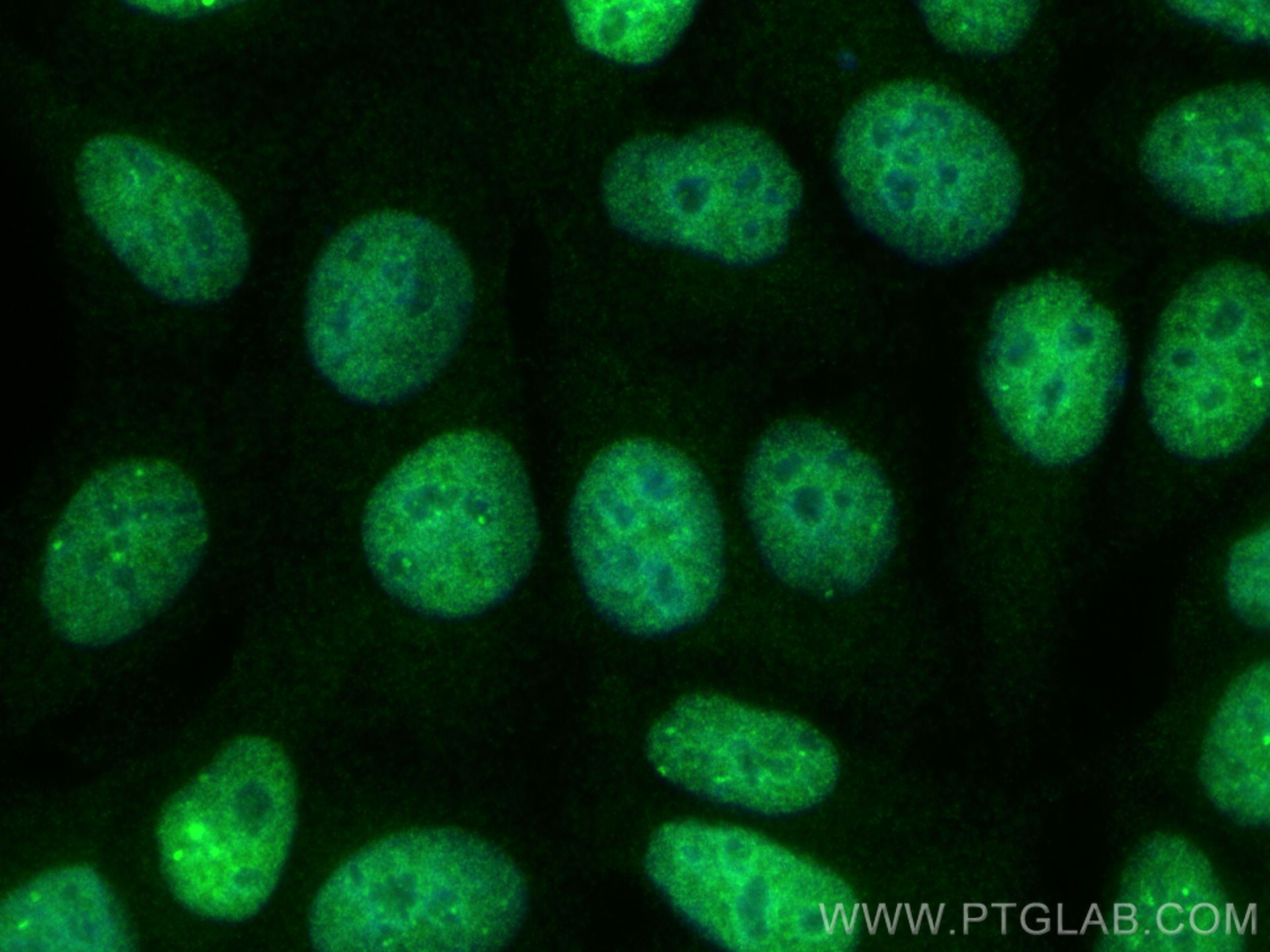 IF Staining of MCF-7 using 29998-1-AP