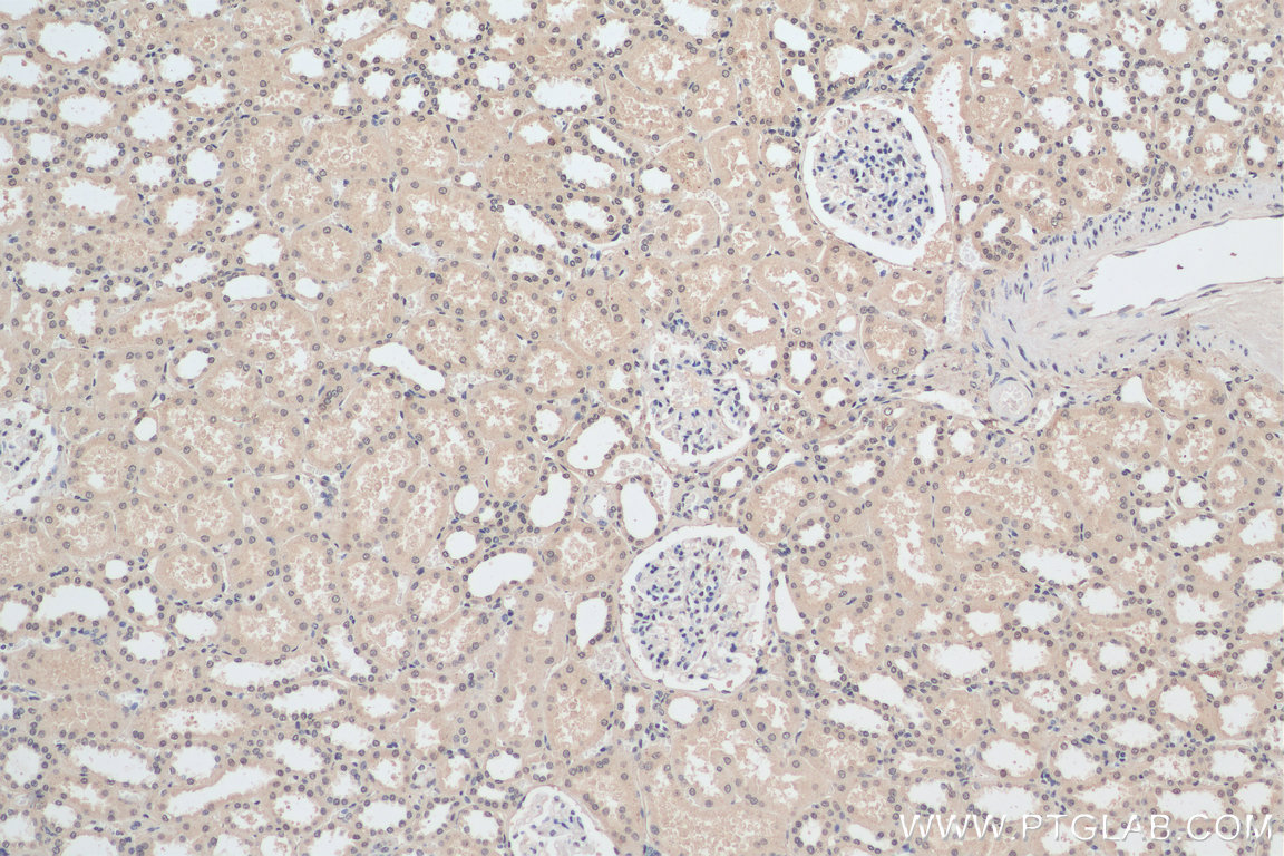 IHC staining of human kidney using 66102-1-Ig