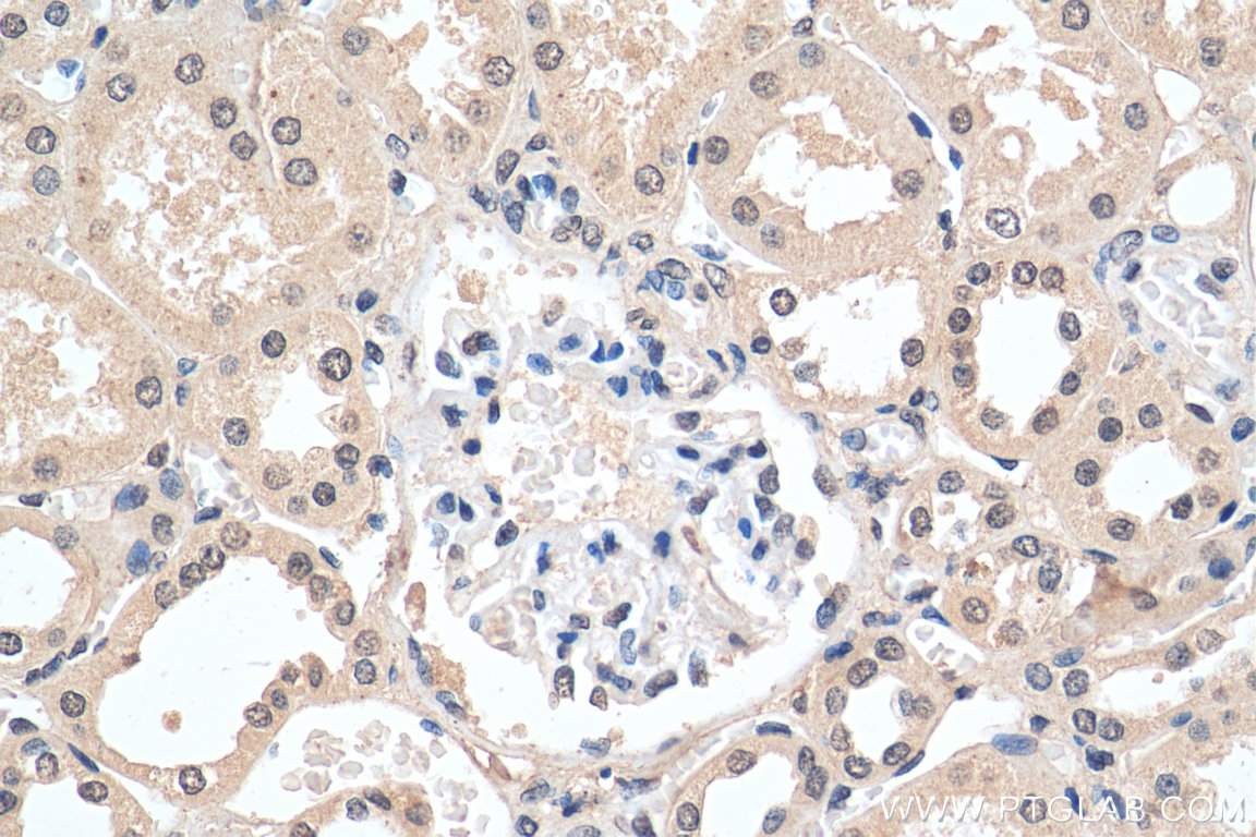 IHC staining of human kidney using 66102-1-Ig