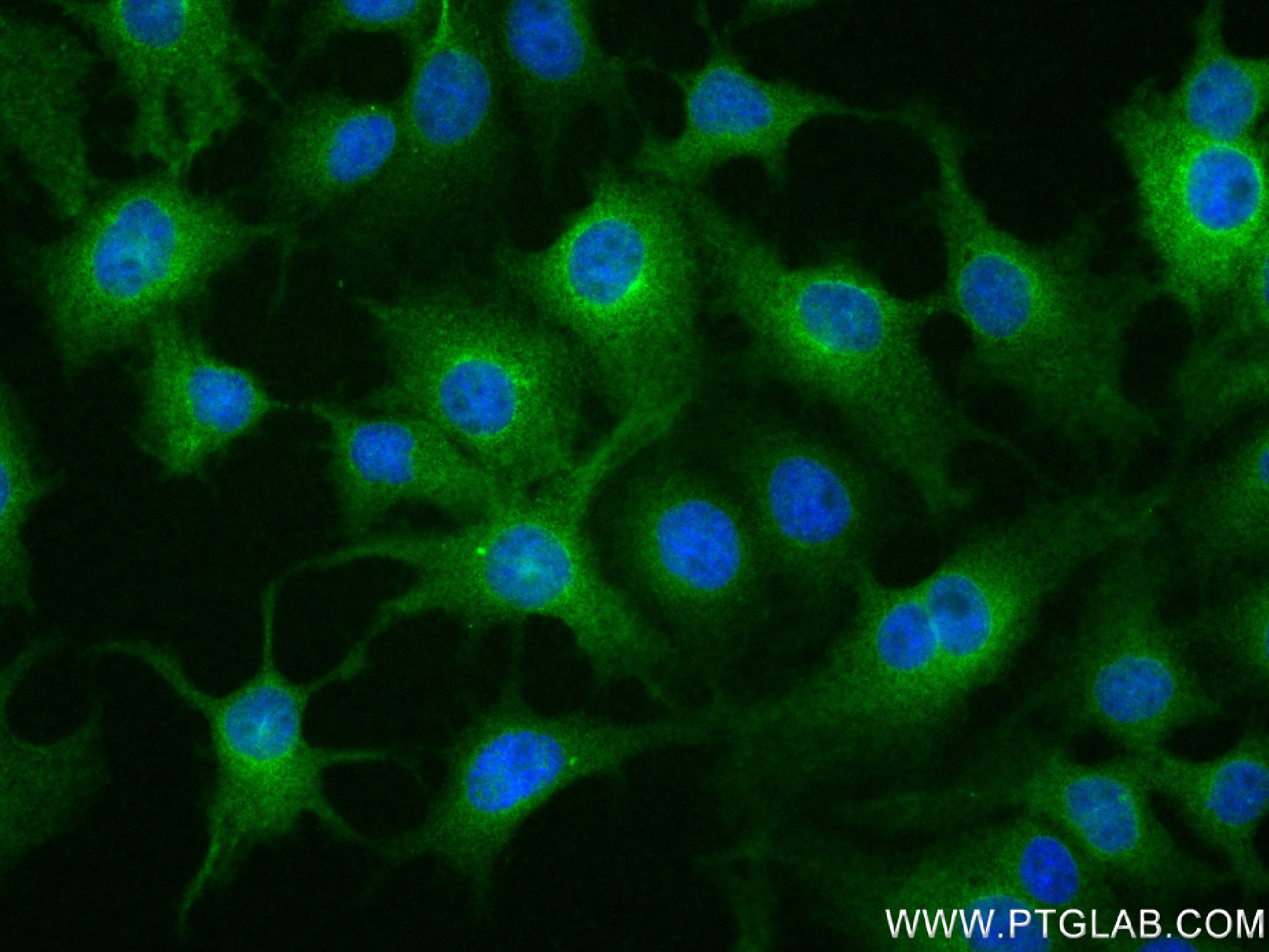 IF Staining of HuH-7 using 83546-3-RR (same clone as 83546-3-PBS)