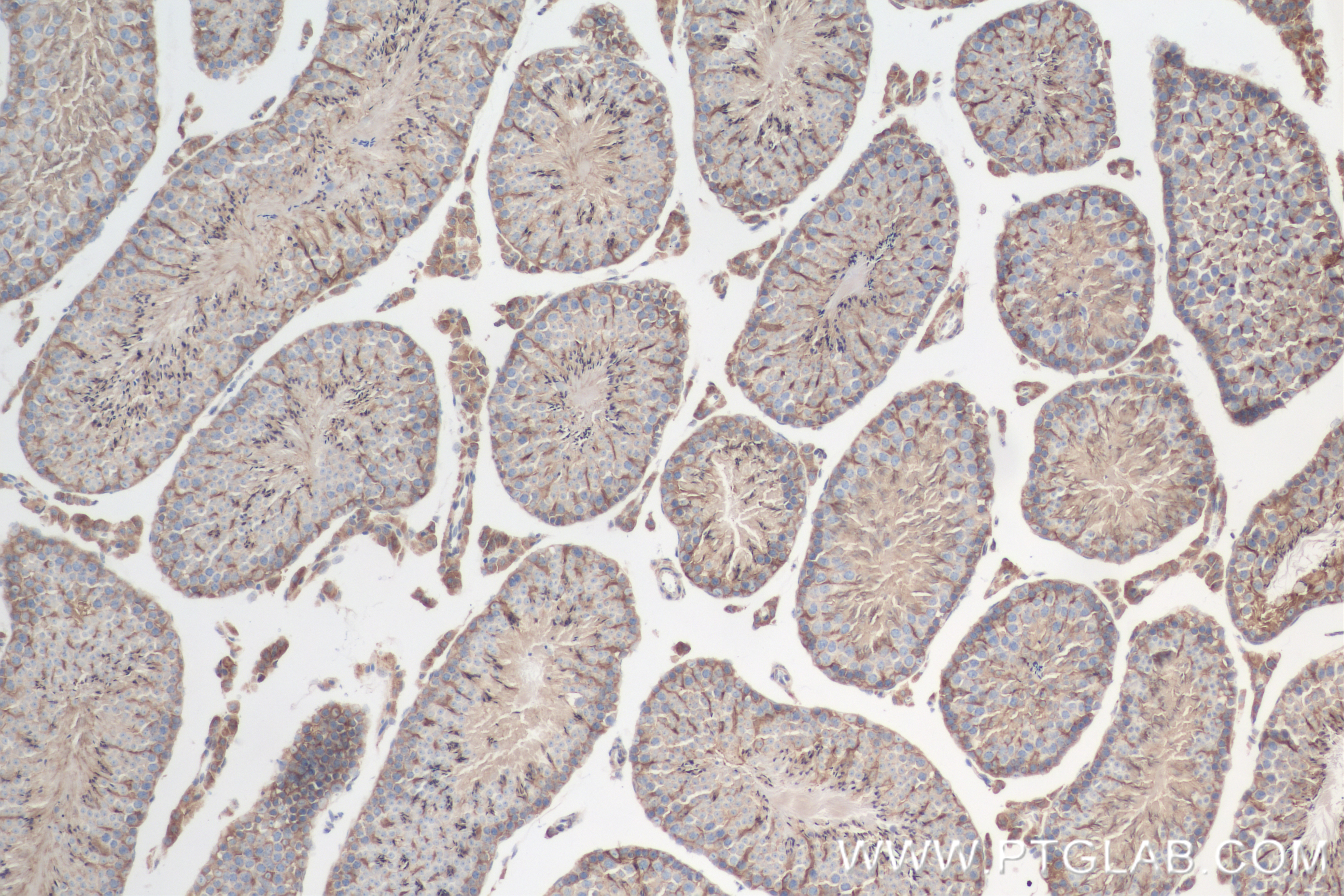 IHC staining of mouse testis using 83546-3-RR (same clone as 83546-3-PBS)