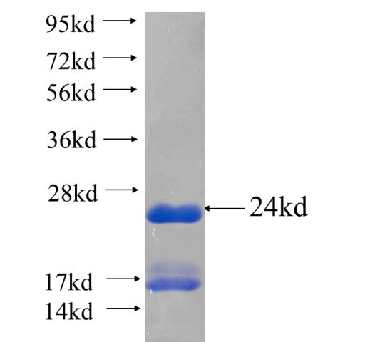 MBP fusion protein Ag24433 SDS-PAGE