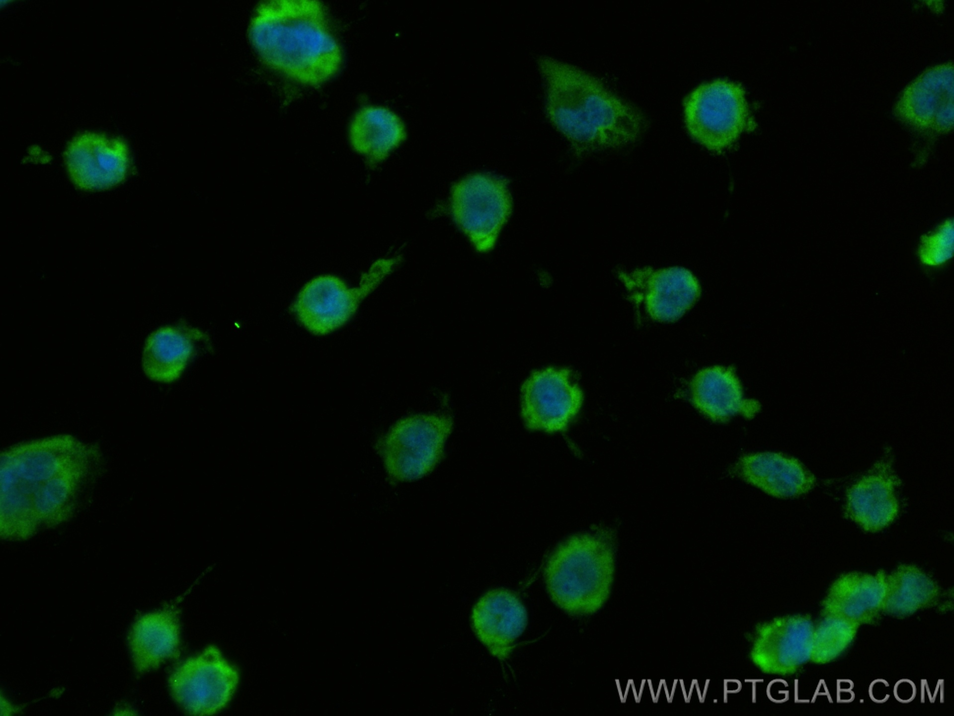 IF Staining of U-251 using 26098-1-AP