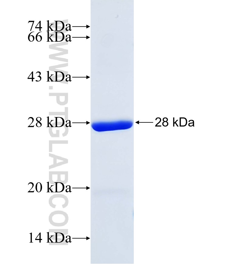 MBTPS1 fusion protein Ag26396 SDS-PAGE