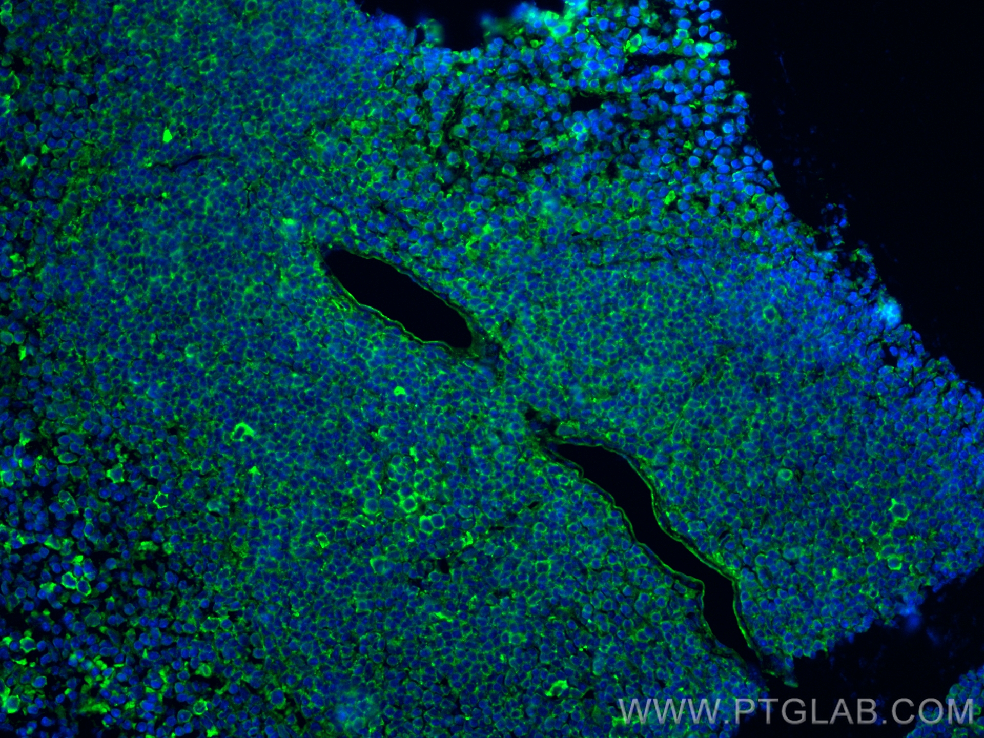 IF Staining of mouse spleen using 17564-1-AP