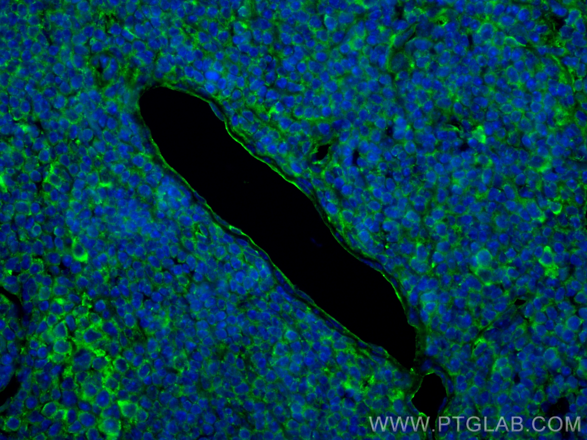 IF Staining of mouse spleen using 17564-1-AP (same clone as 17564-1-PBS)