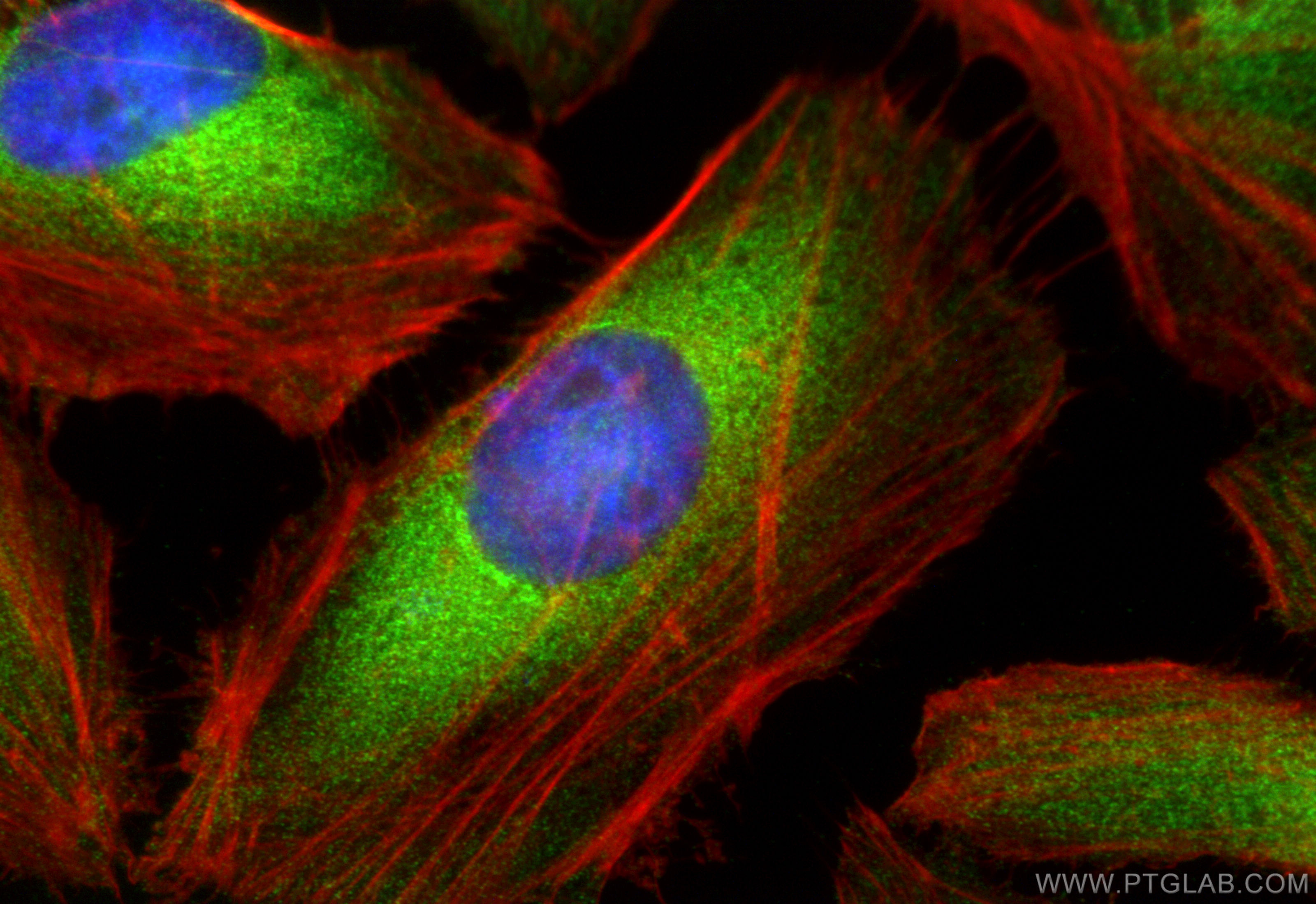 IF Staining of HeLa using 11525-1-AP