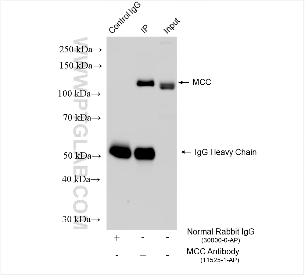 IP experiment of HeLa using 11525-1-AP