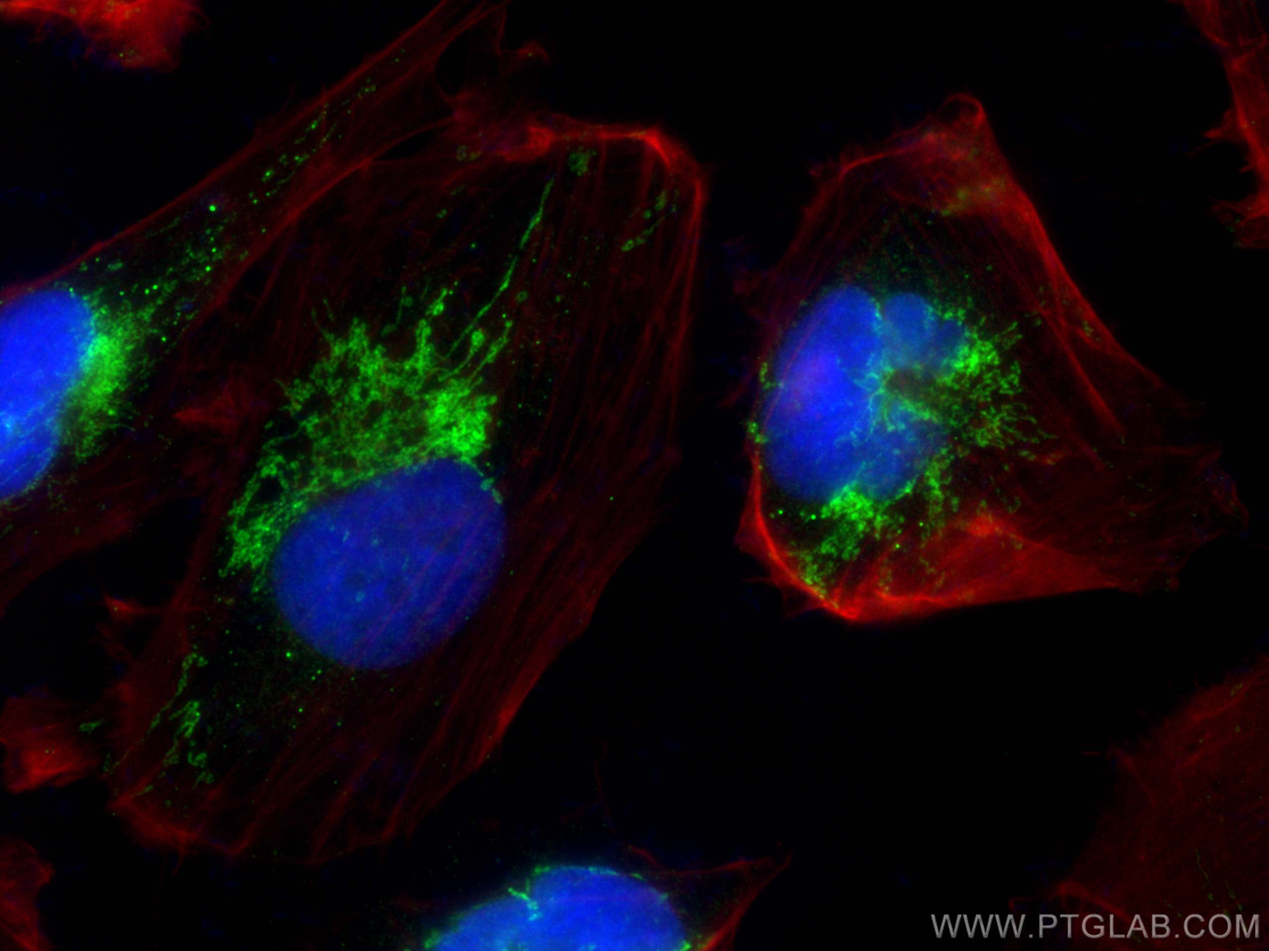 IF Staining of U-251 using 30081-1-AP