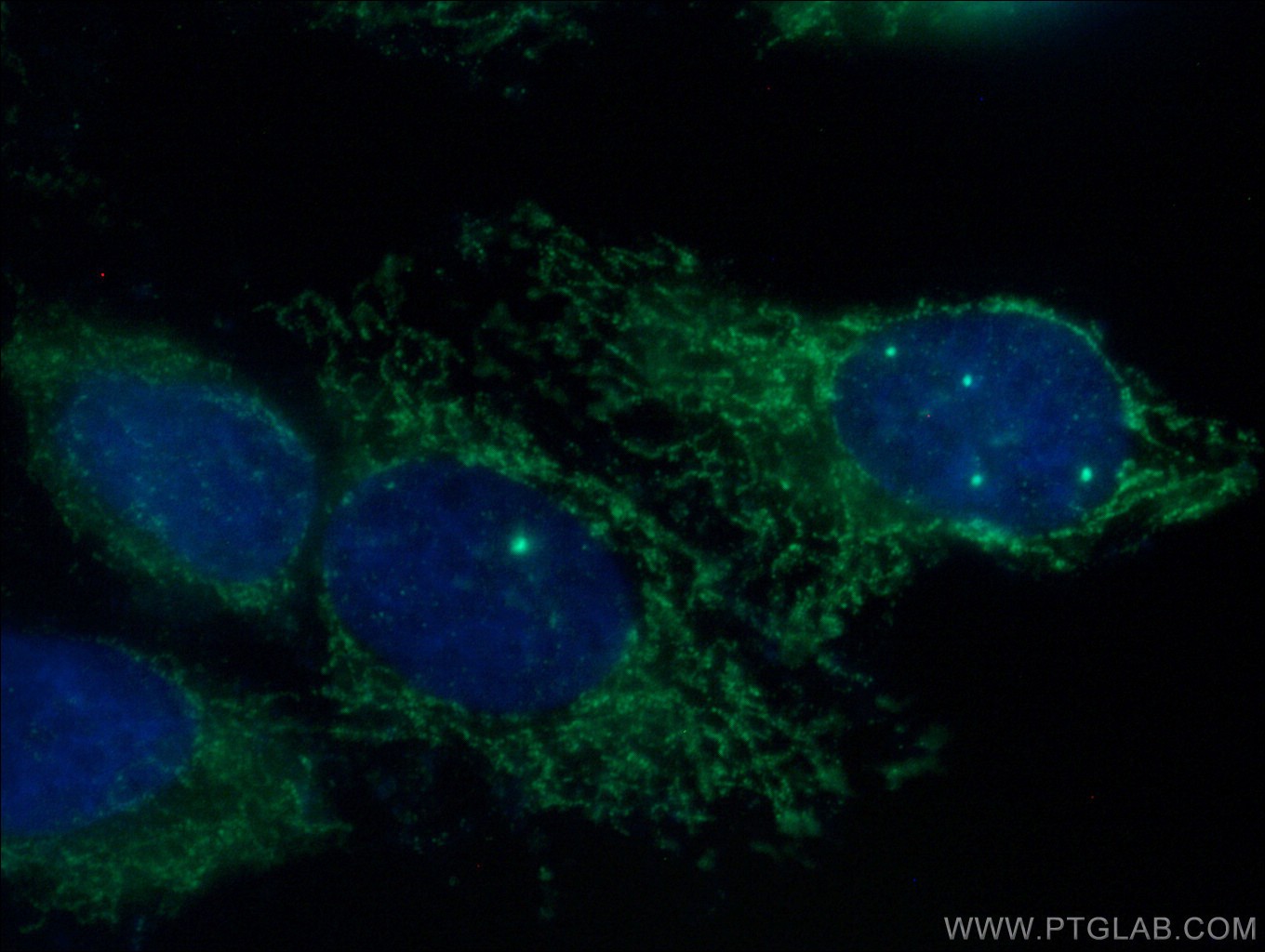 IF Staining of HepG2 using 16499-1-AP