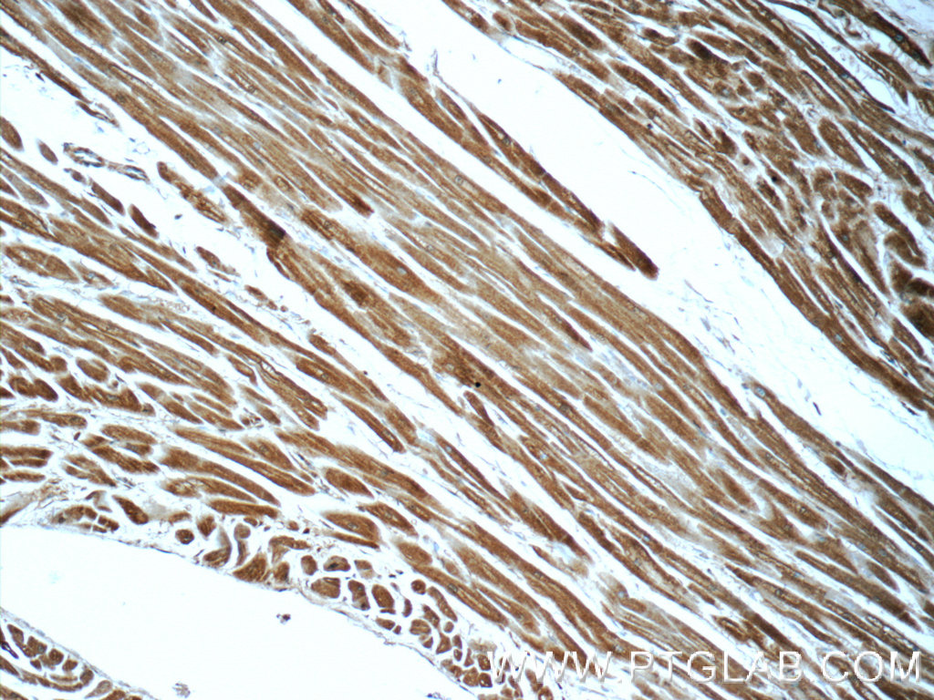 IHC staining of human heart using 10163-1-AP