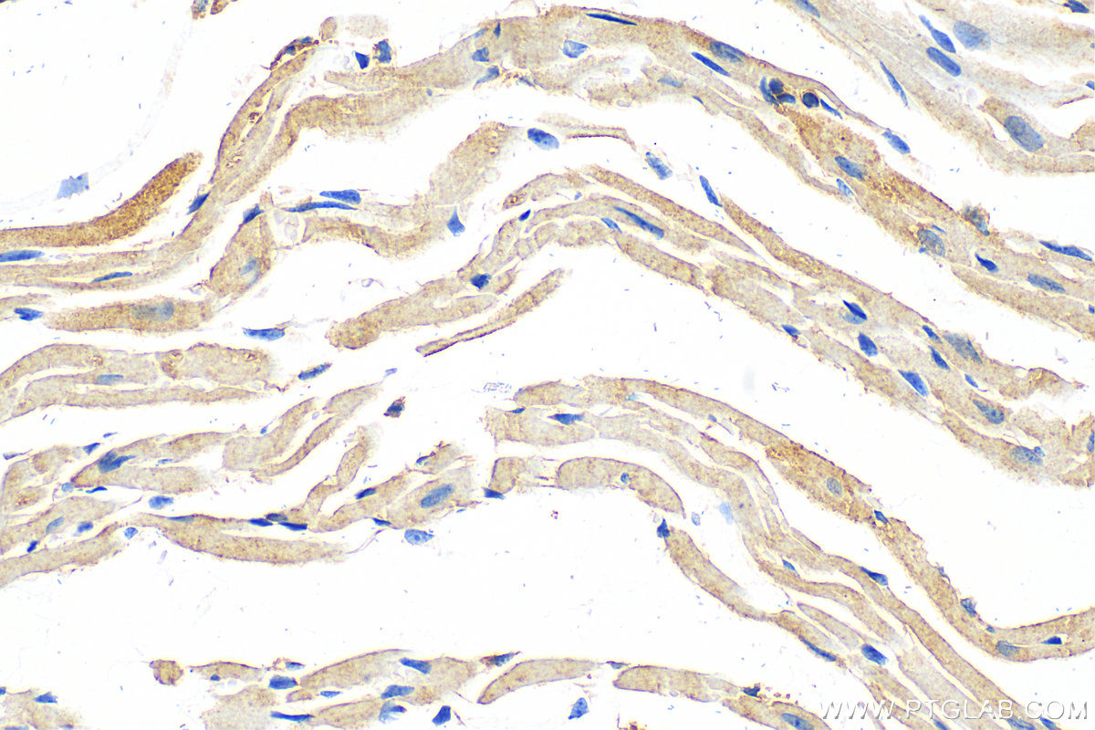 IHC staining of mouse heart using 11656-2-AP