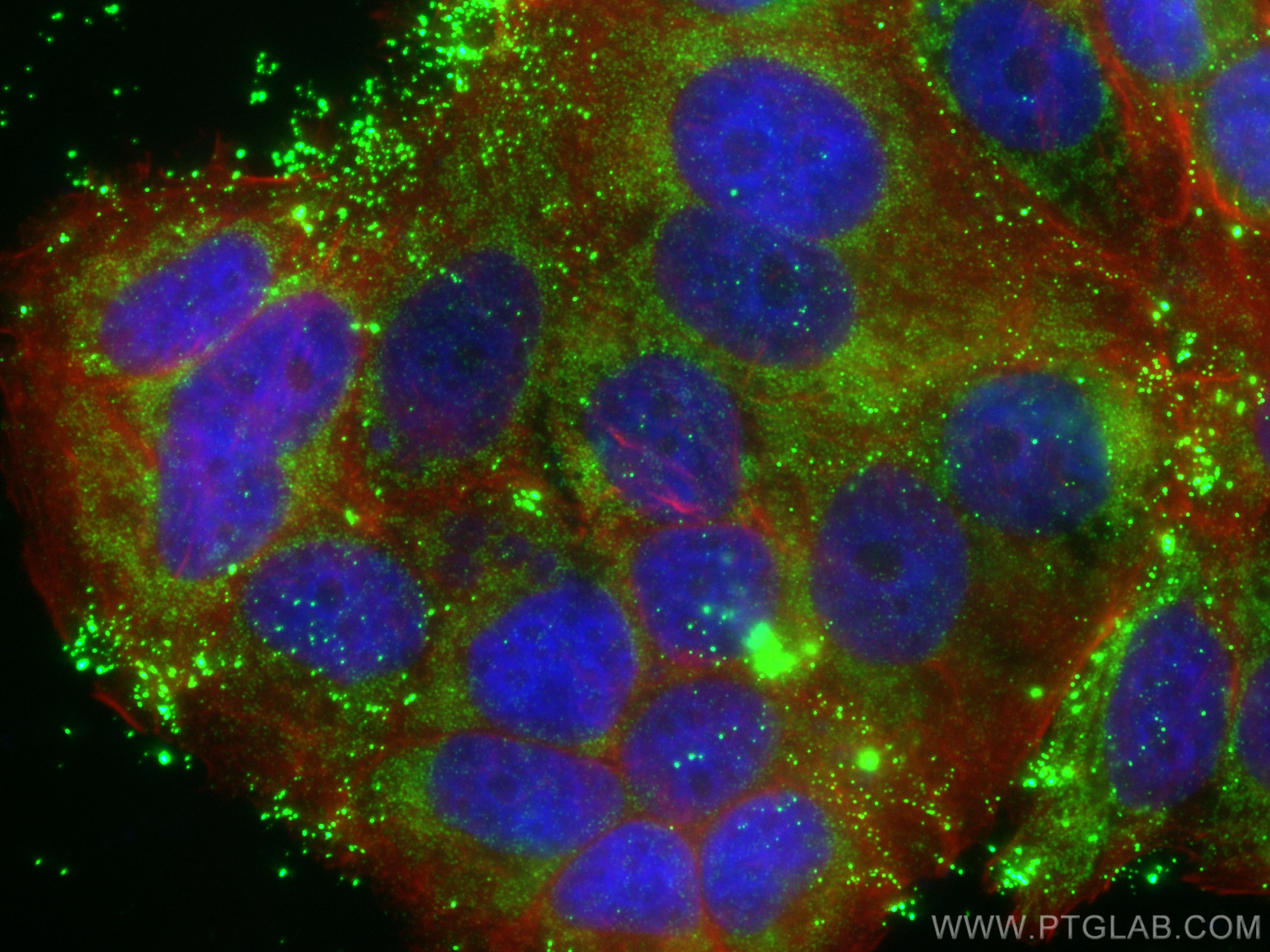 IF Staining of MCF-7 using 82695-4-RR