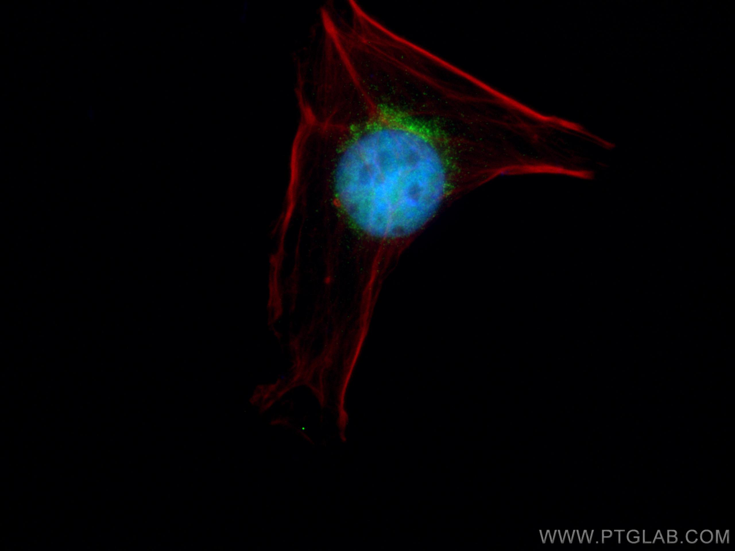 IF Staining of HeLa using 10513-1-AP