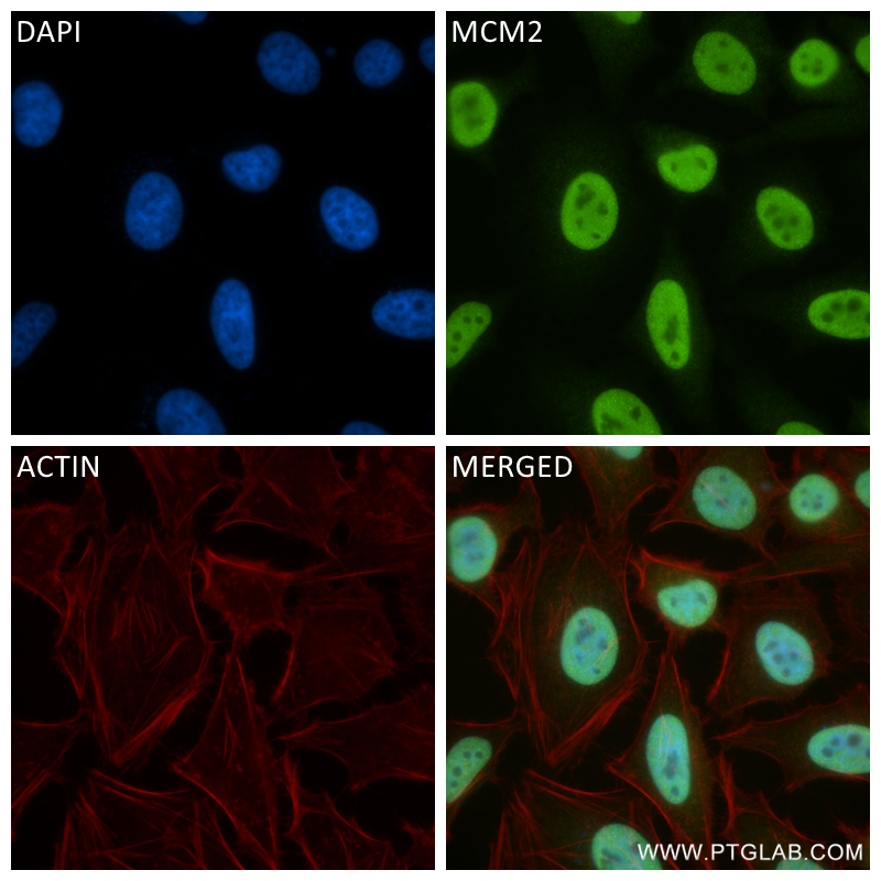 IF Staining of HeLa using 84511-2-RR