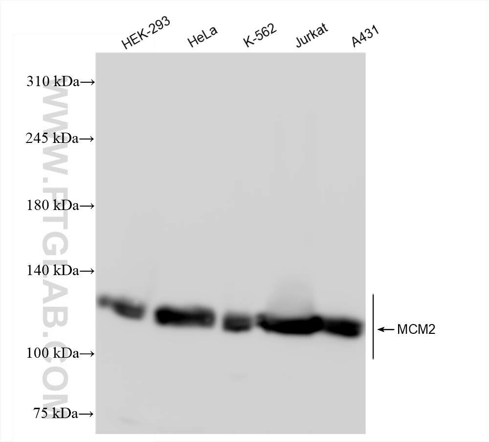 WB analysis using 84511-2-RR