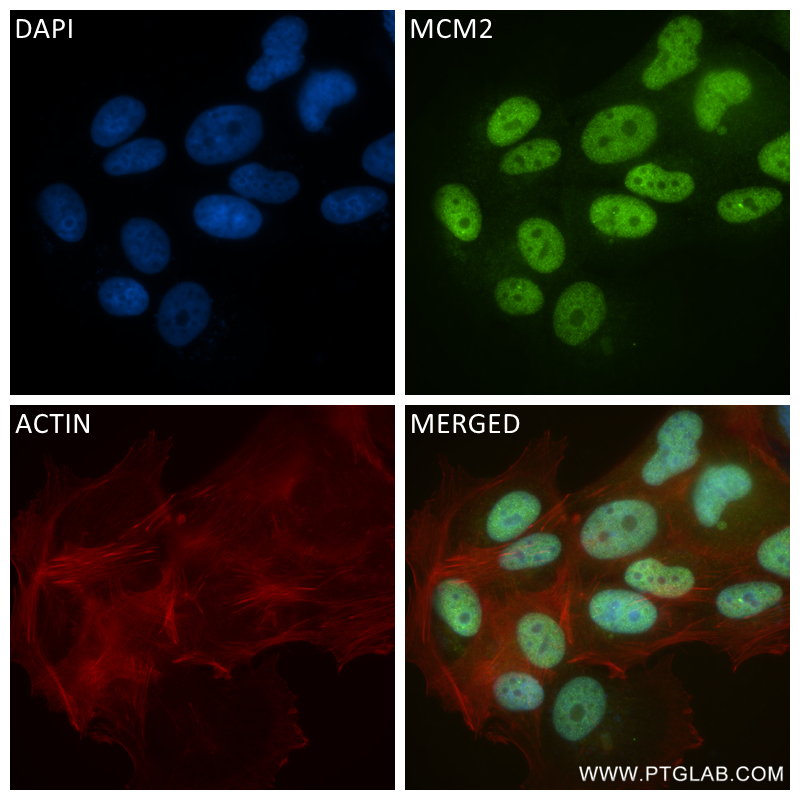 IF Staining of MCF-7 using 84511-5-RR (same clone as 84511-5-PBS)