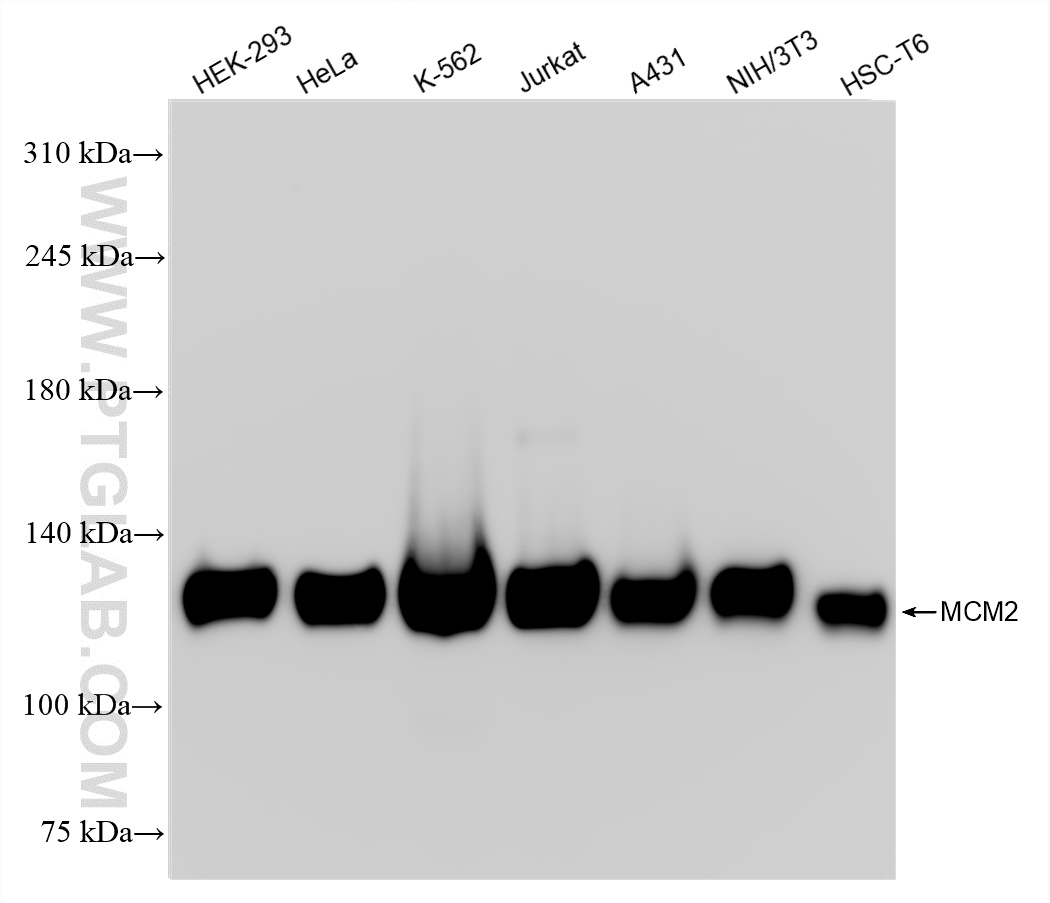 WB analysis using 84511-5-RR (same clone as 84511-5-PBS)