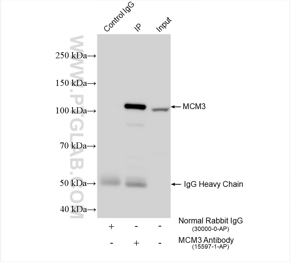 IP experiment of HeLa using 15597-1-AP