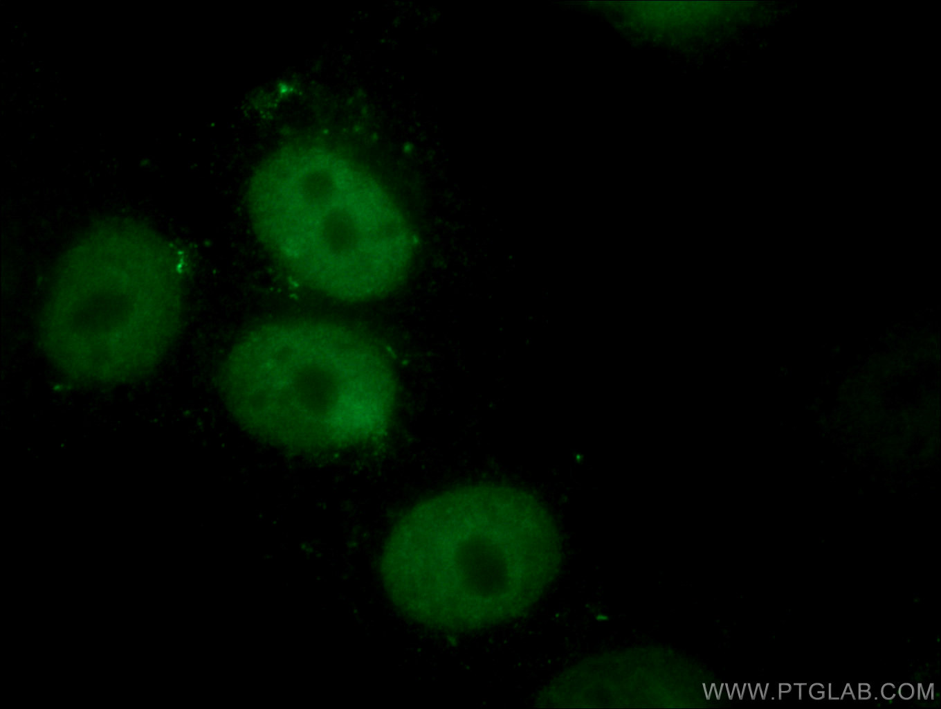 IF Staining of HepG2 using 67049-1-Ig (same clone as 67049-1-PBS)