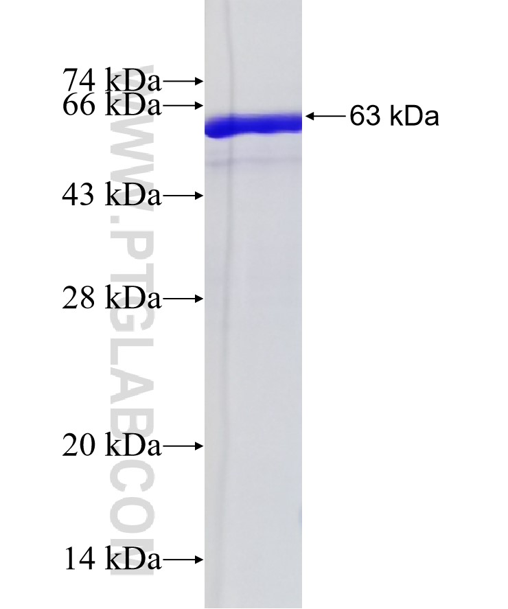 MCM9 fusion protein Ag4108 SDS-PAGE