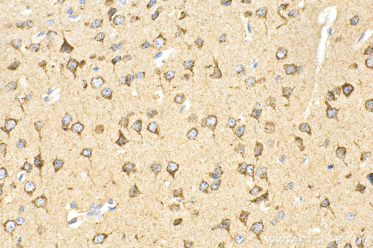 IHC staining of mouse brain using 15291-1-AP