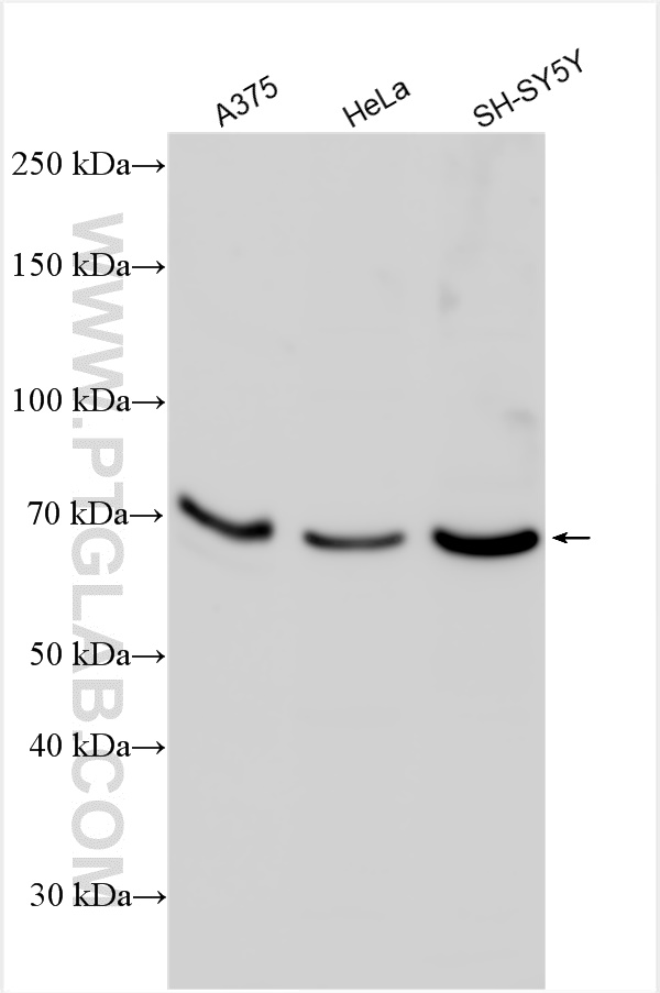 WB analysis using 13879-1-AP