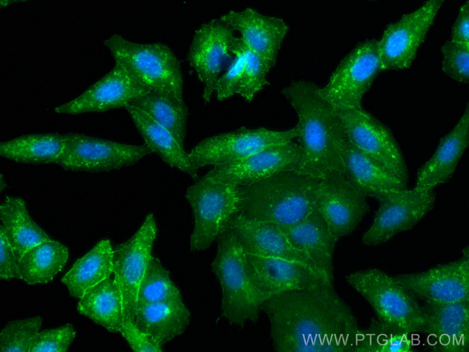 IF Staining of HepG2 using 20139-1-AP