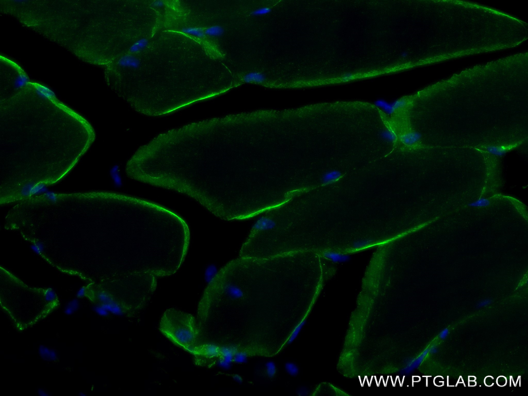 IF Staining of mouse skeletal muscle using 84797-4-RR (same clone as 84797-4-PBS)