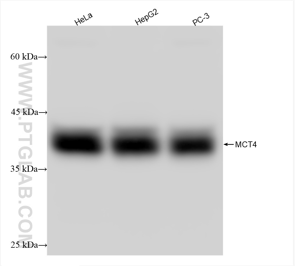 WB analysis using 84797-4-RR (same clone as 84797-4-PBS)