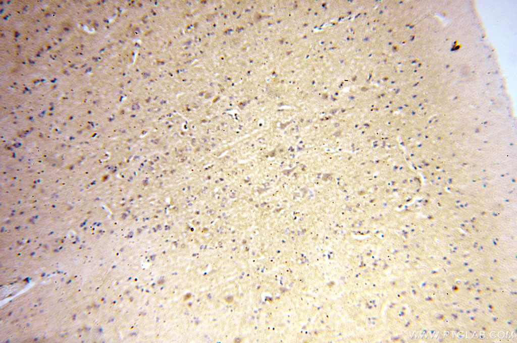 IHC staining of human brain using 17578-1-AP