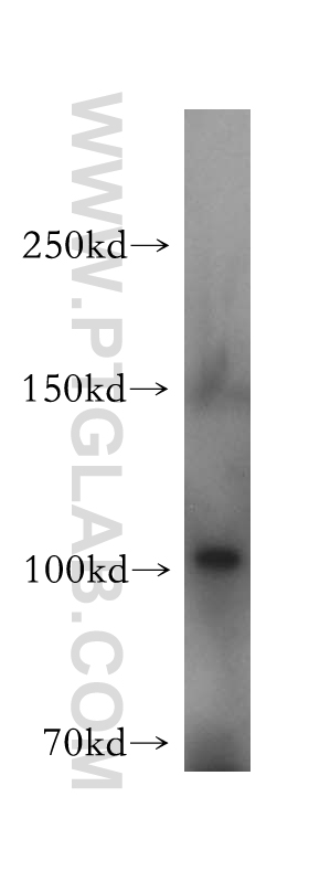 WB analysis of mouse liver using 17578-1-AP