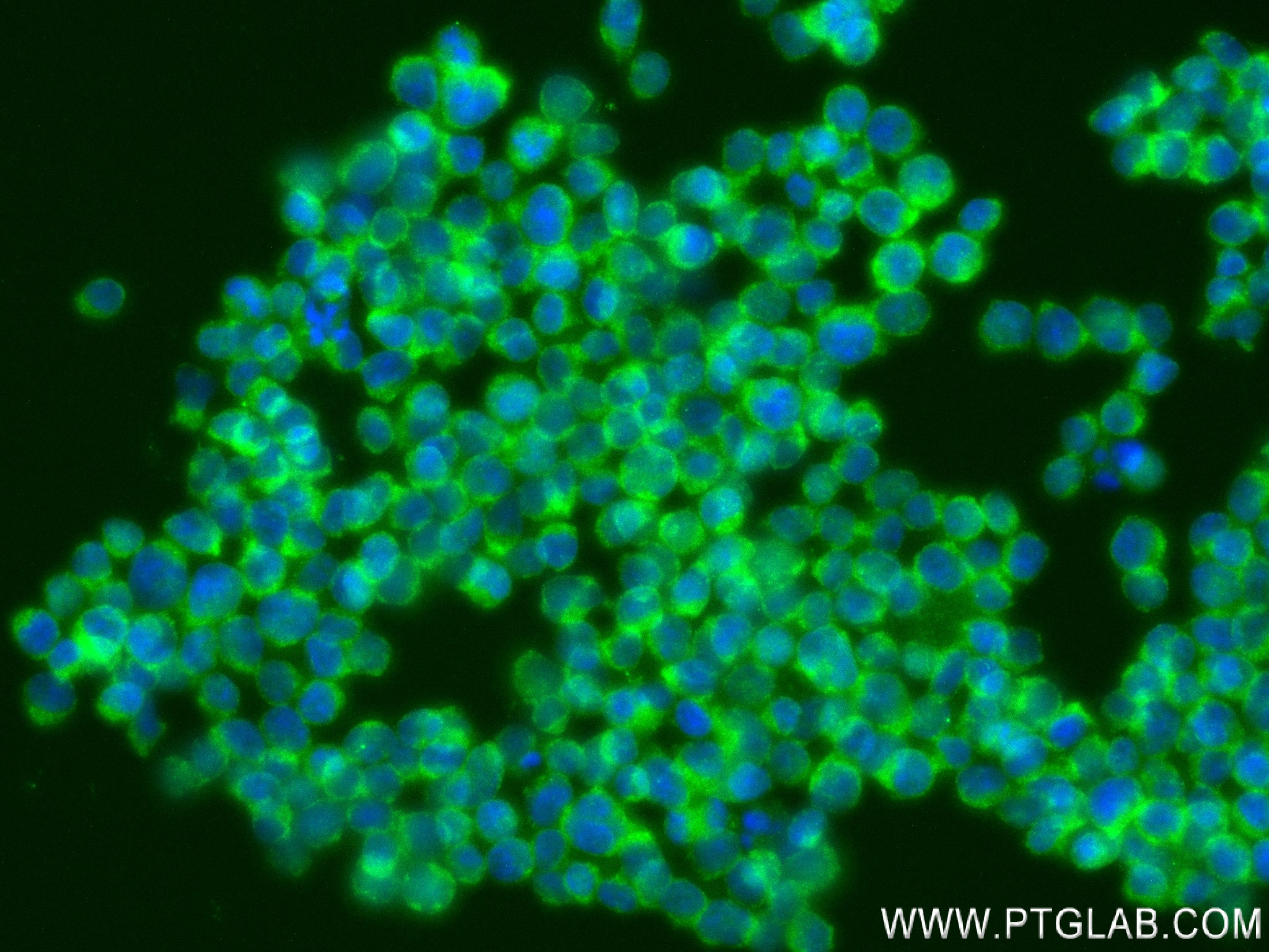 IF Staining of Jurkat using 84312-5-RR (same clone as 84312-5-PBS)