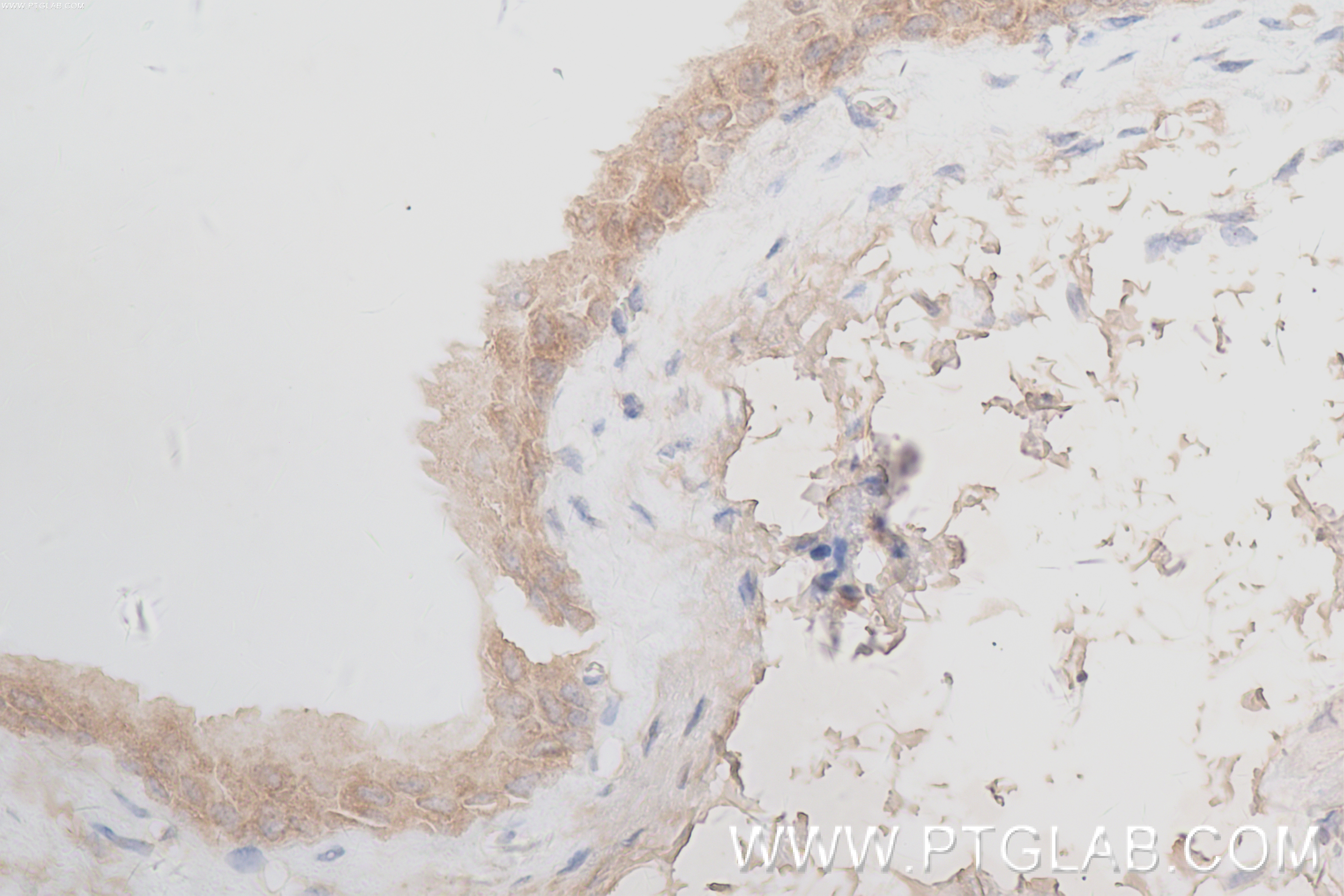 IHC staining of mouse bladder using 84312-5-RR (same clone as 84312-5-PBS)