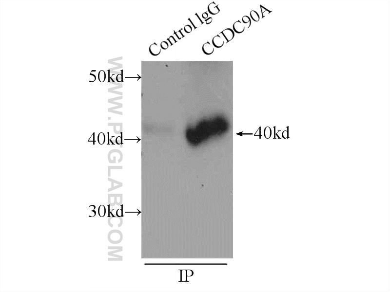 IP experiment of HEK-293 using 24948-1-AP