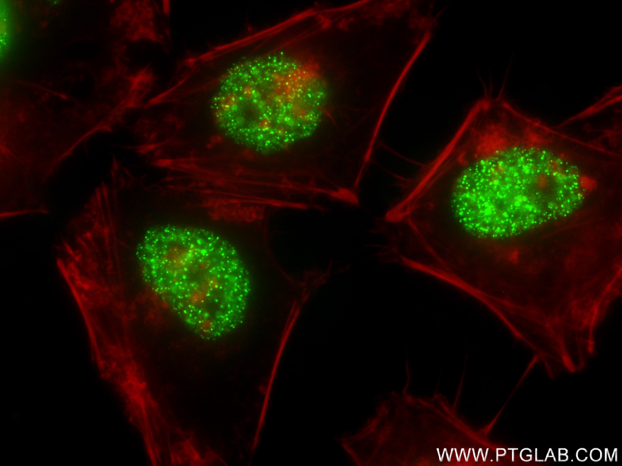 IF Staining of HeLa using 83496-1-RR (same clone as 83496-1-PBS)