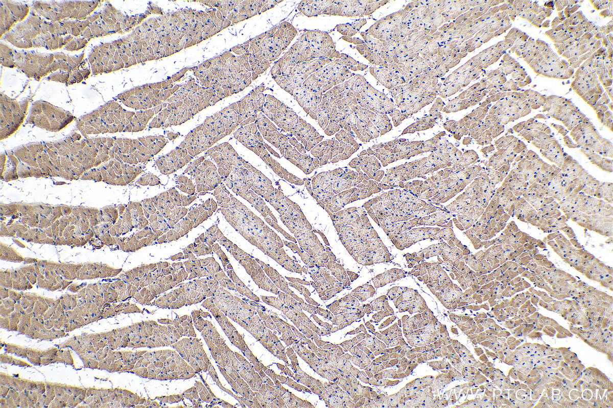 IHC staining of rat heart using 66505-1-Ig