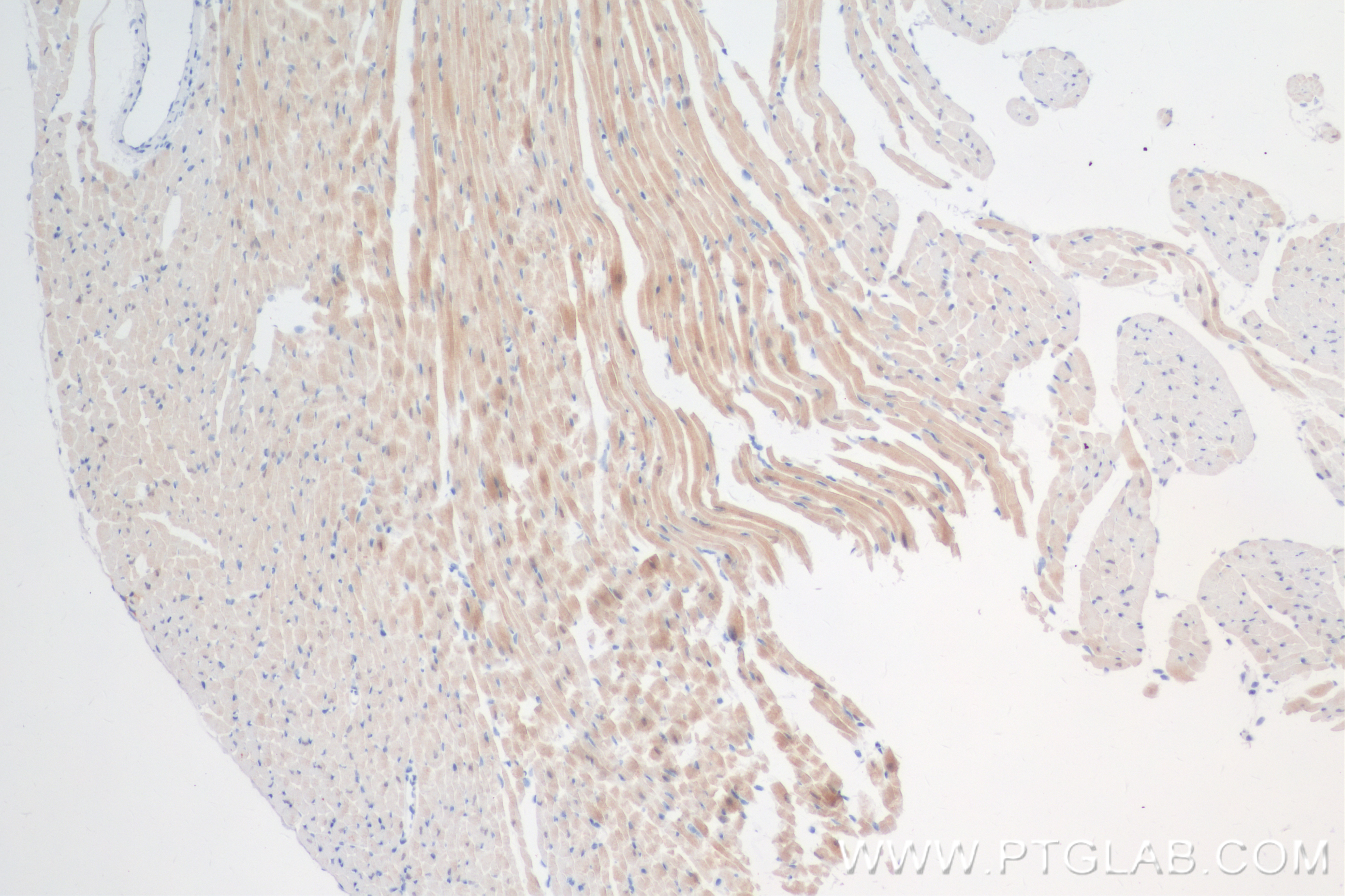 IHC staining of mouse heart using 84576-4-RR